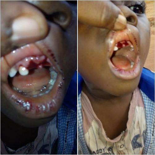 See What A Teacher Did To A 4-Year Old Pupil