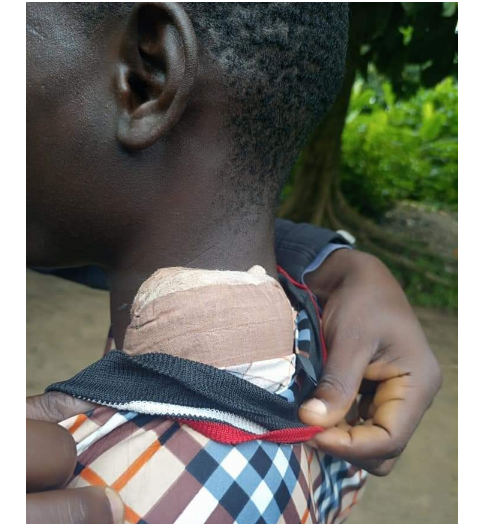 JSS 2 student stabs school prefect over wrong stockings
