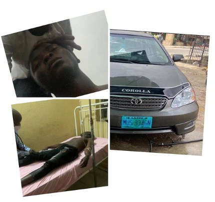 Bribe-seeking police officer tortures UNILAG student to a coma