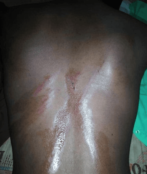 Nigerian Student Says He Was Flogged by Teachers for Identifying as a Marlian