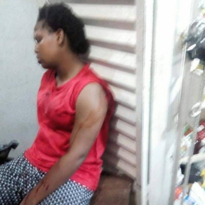 100 Level Female FUPRE Student Attacked, Stabbed Multiple Times (Graphic)