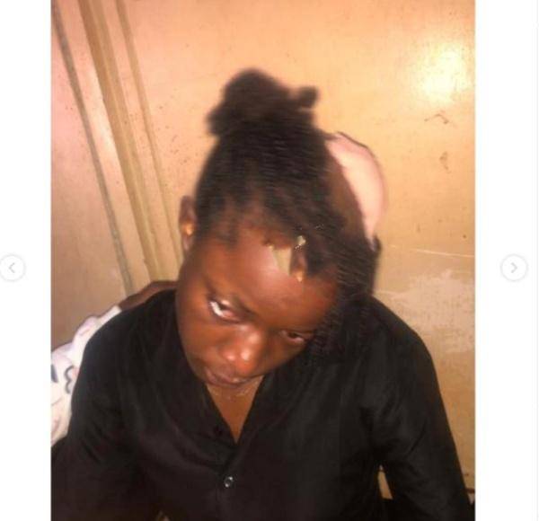 UNN student lands in the hospital after a lecturer broke her head with a stone