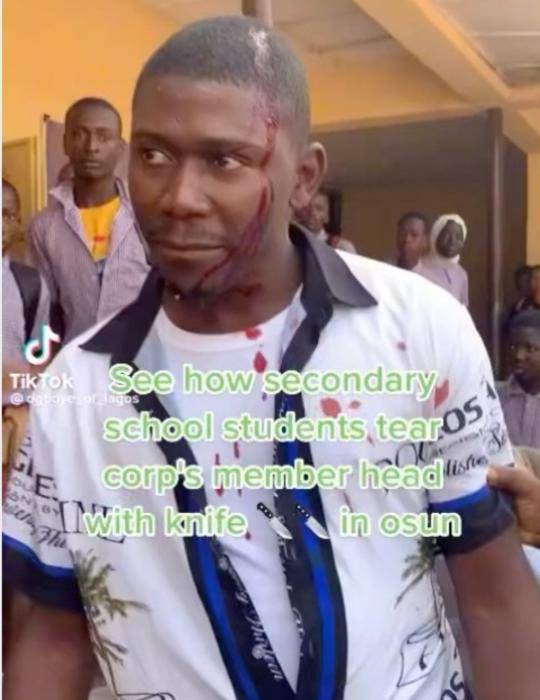 Corps member bleeds from the head after being attacked by students